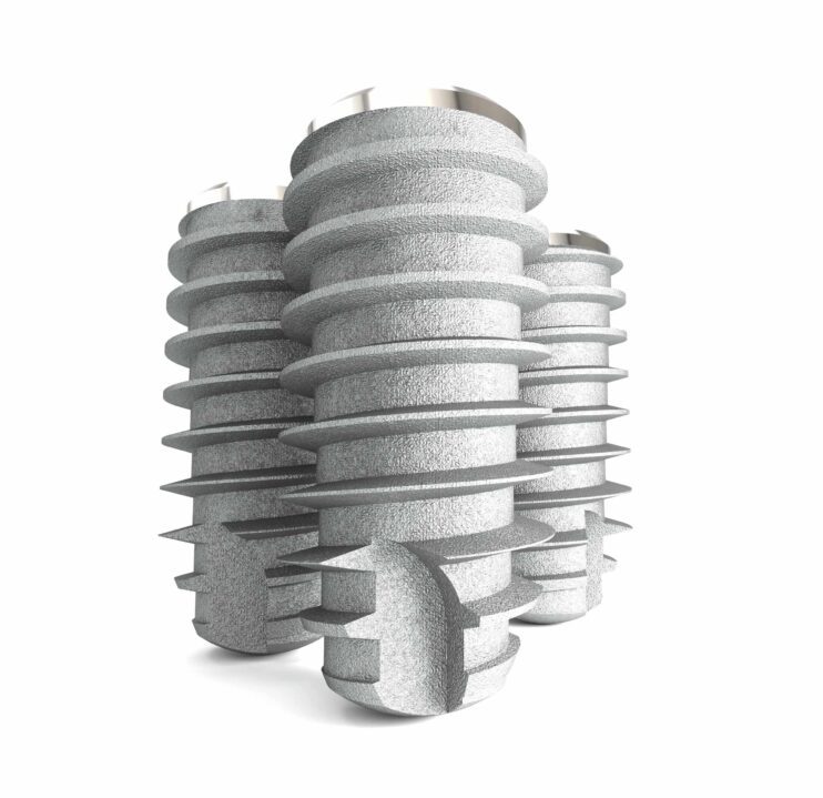 3D render van een drietal dentale implantaten