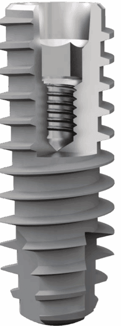 Close up van IESS TC implantaat